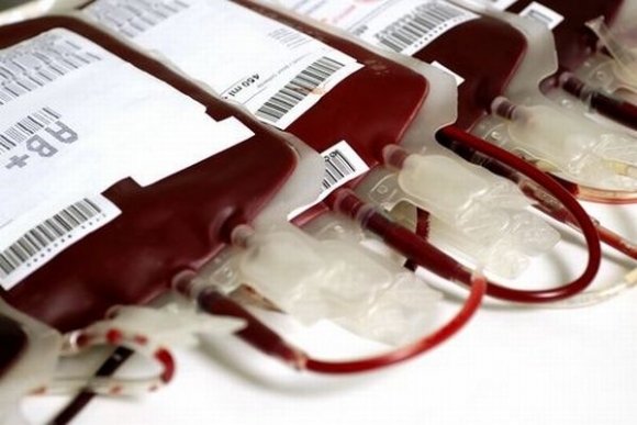 Krv, transfúzia