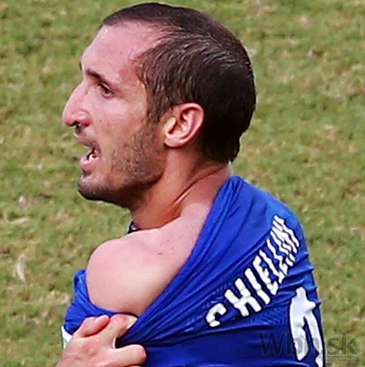 Chiellini suarez