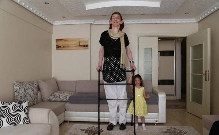 Najvyššia tínedžerka sveta je z Turecka, meria vyše 213 cm