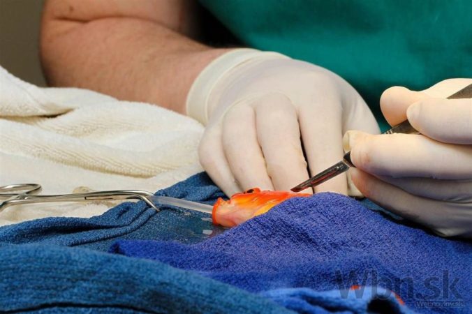 Žena nechala zlatej rybke operovať nádor, pomaly sa zotavuje