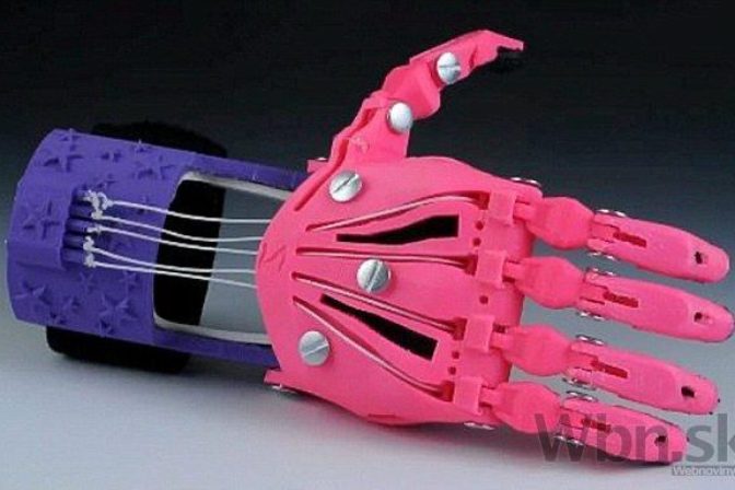 Dievčatku bez prstov vytlačili protézu ruky v 3D tlačiarni