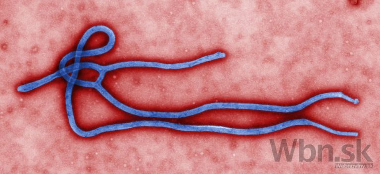 ebola
