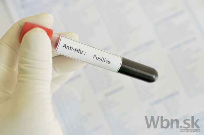 HIV, AIDS, krv