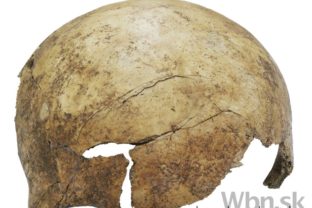 V Hesensku našli masový hrob obetí násilia spred asi 7000 rokov