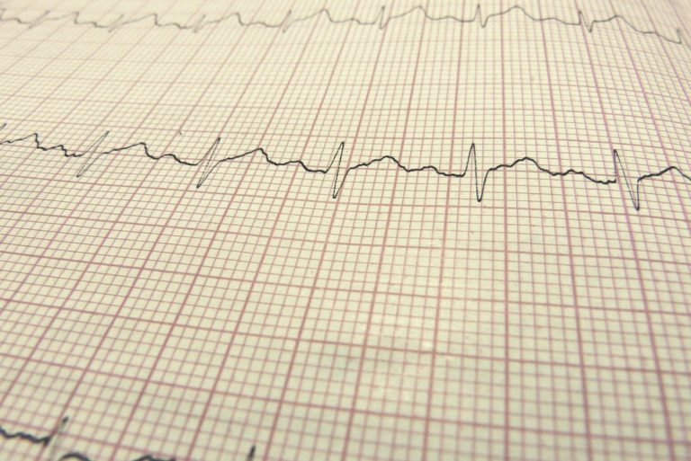 Ekg_graf