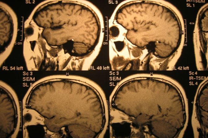 Mri.jpg