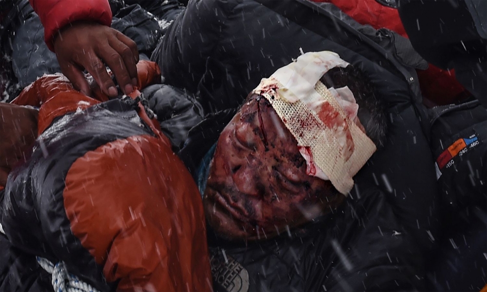 Víťazné fotografie World Press Photo za rok 2015