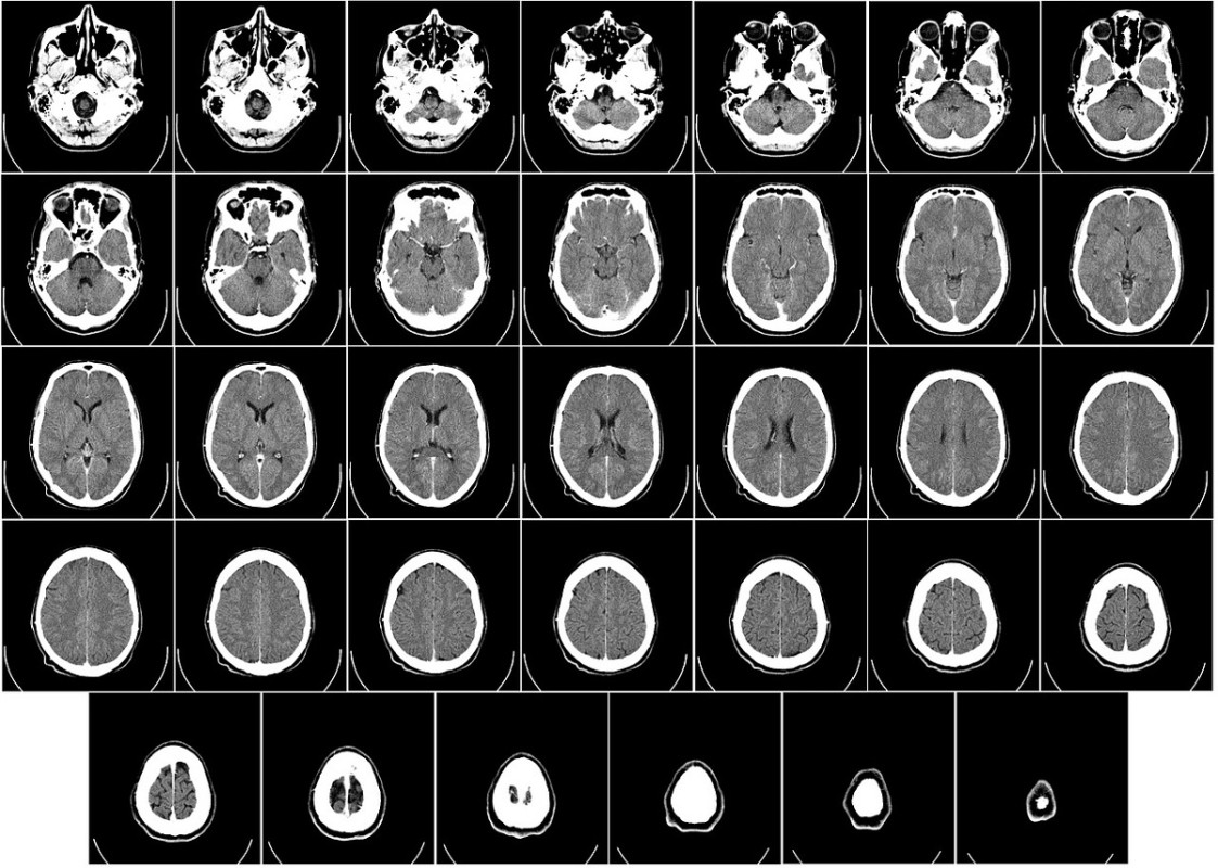 Computer tomography 62942_1280.jpg