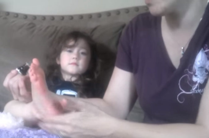 Video: Matka takto jednoducho vytiahla dcére hlbokú triesku