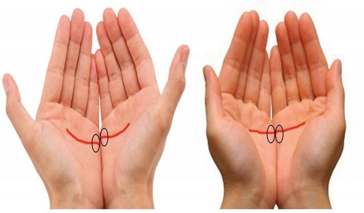 Čo znamenajú tieto čiary na vašich rukách?