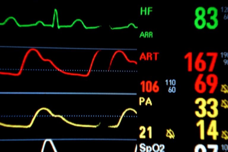 Ekg_monitor.jpg
