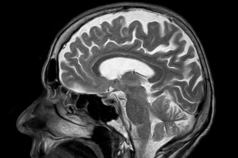Mri_snimok.jpg