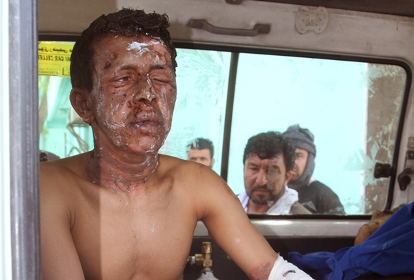 V Afganistane sa zrazili dva autobusy s palivovou cisternou