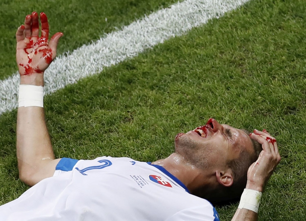 ME vo futbale 2016: Slovensko - Anglicko