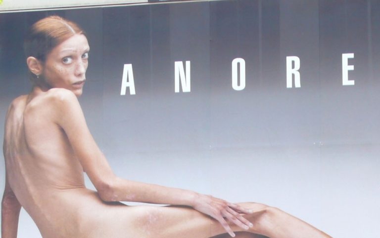 Anorexia