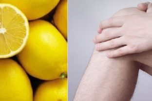 Takto sa pomocou citróna môžete zbaviť bolesti kolena