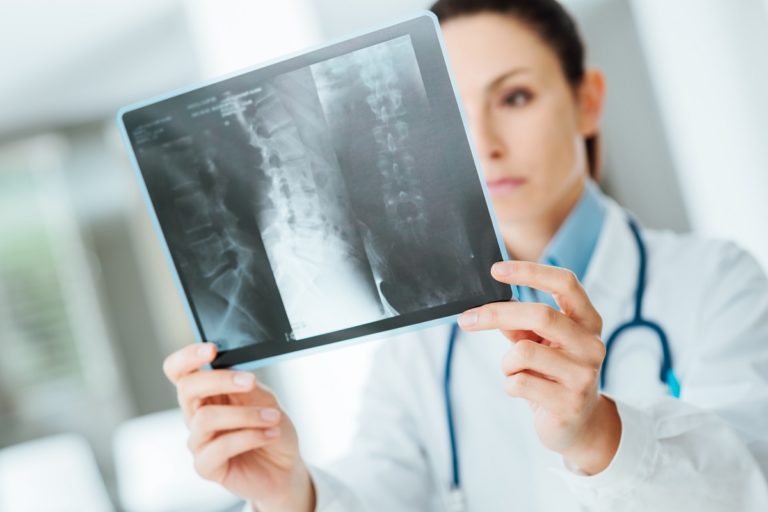 Female doctor examining an x ray