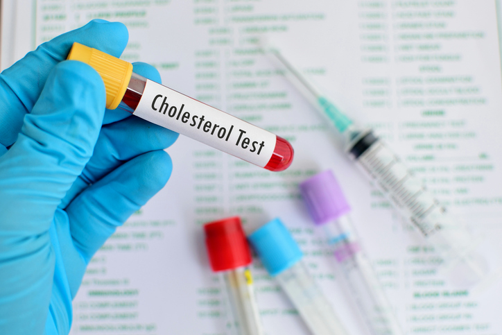 Cholesterol test