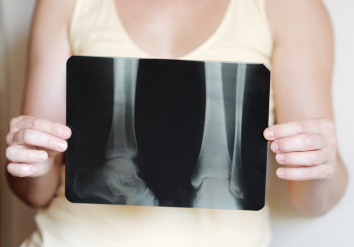 X ray image of legs