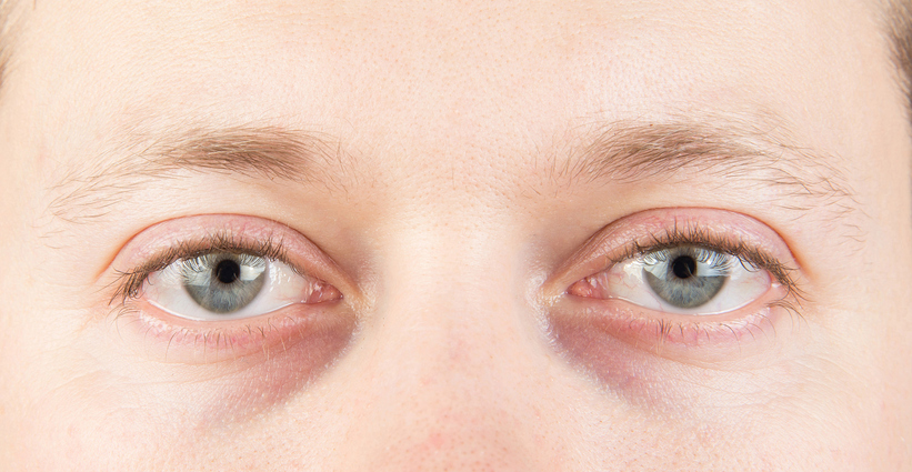 Man&#039;s tired eyes