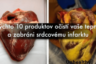 Týchto 10 produktov očistí vaše tepny a zabráni srdcovému infarktu