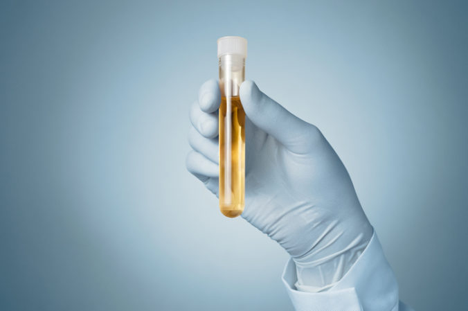 Doctor&#039;s hand with urine sample