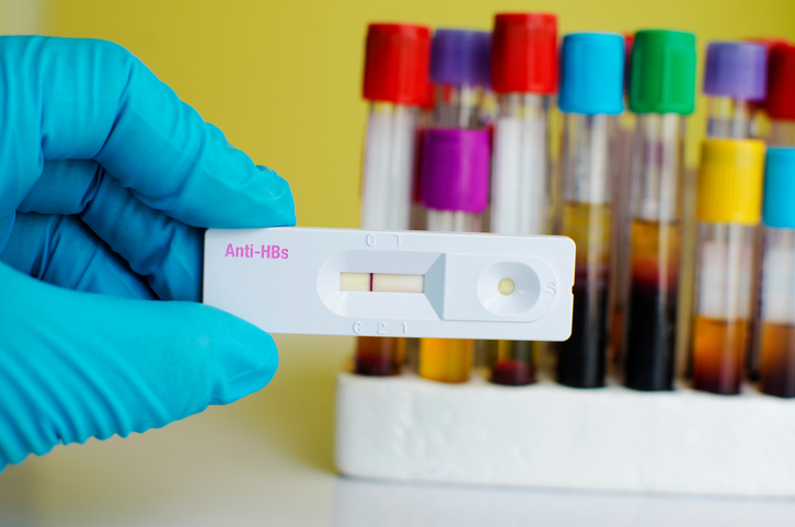 Anti HBs negative