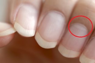 Mali by ste vedieť, čo je to lunula.