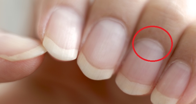 Mali by ste vedieť, čo je to lunula.