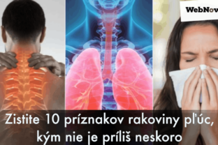 Zistite 10 príznakov rakoviny pľúc, kým nie je príliš neskoro