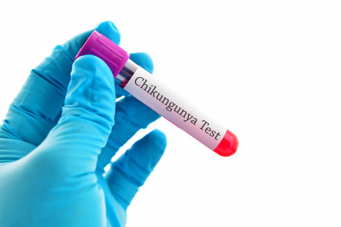 Chikungunya virus test