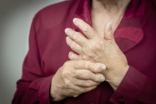 Hands Of Woman Deformed From Rheumatoid Arthritis. Pain