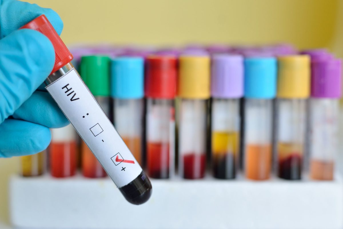 HIV, AIDS