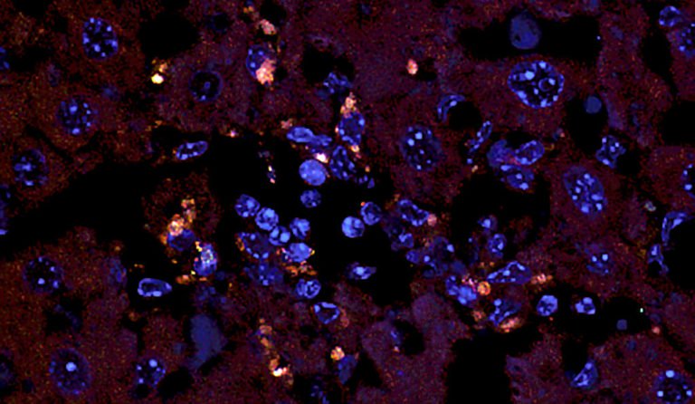E.gallinarum_ts_yale 768x446.jpg