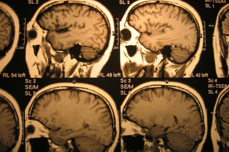 Mri.jpg