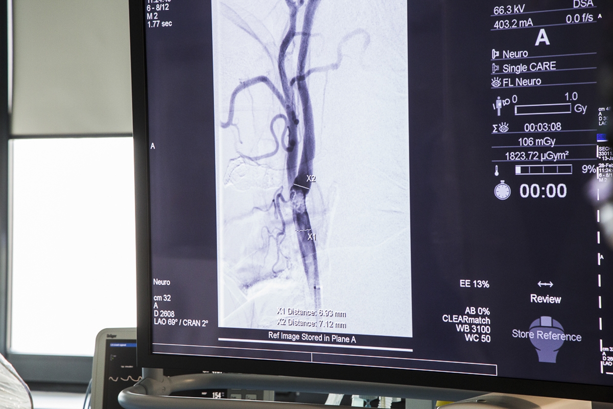 Chirurgia_stent.jpg