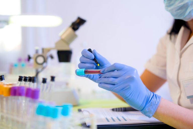 Krvný test, laboratórium