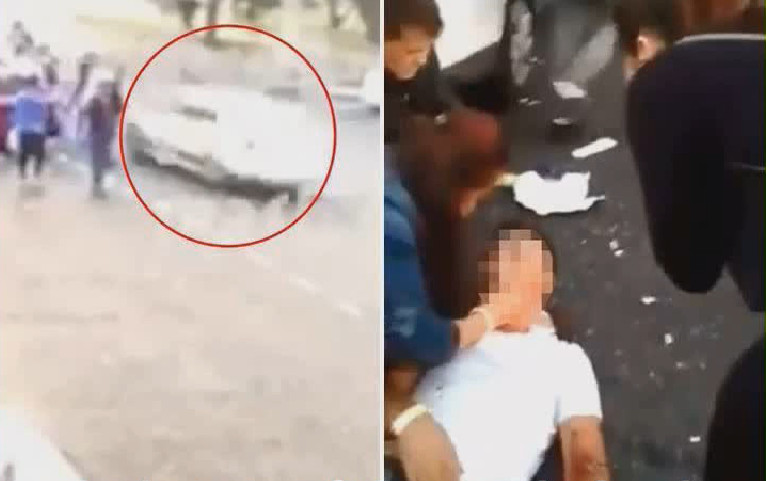 Rusko, auto, zrážka auta s osobou