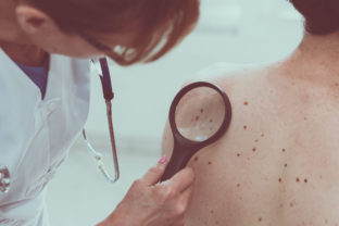 Dermatologist examining the skin of a patient