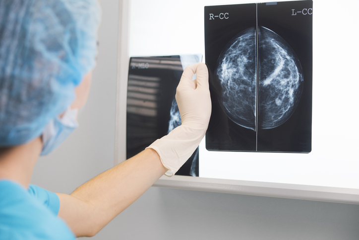 doktor, mamogram