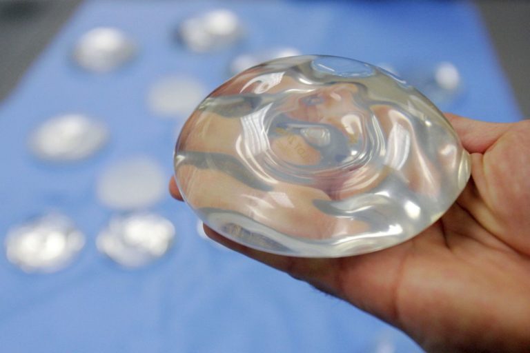 Breast Implants