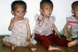podvýživa, deti, Severná Kórea