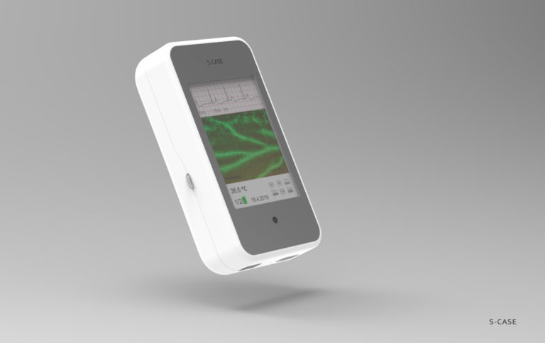 Ts_uk_studenti vyvinuli medicinsko technologicke zariadenie s case_2.jpg