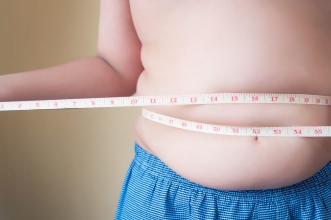Obezitou trpí až sedem z desiatich Slovákov. Lekár radí, ako úspešne schudnúť