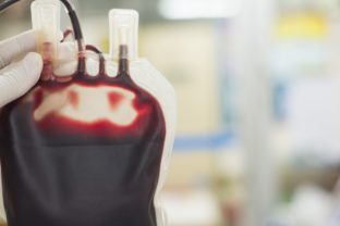 transfúzia, krv