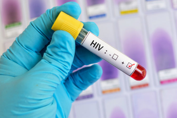 HIV, lekár, test krvi