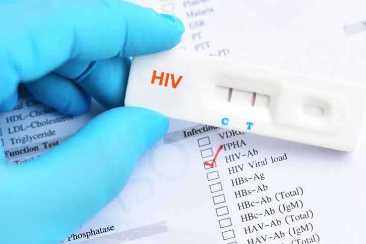 Test HIV