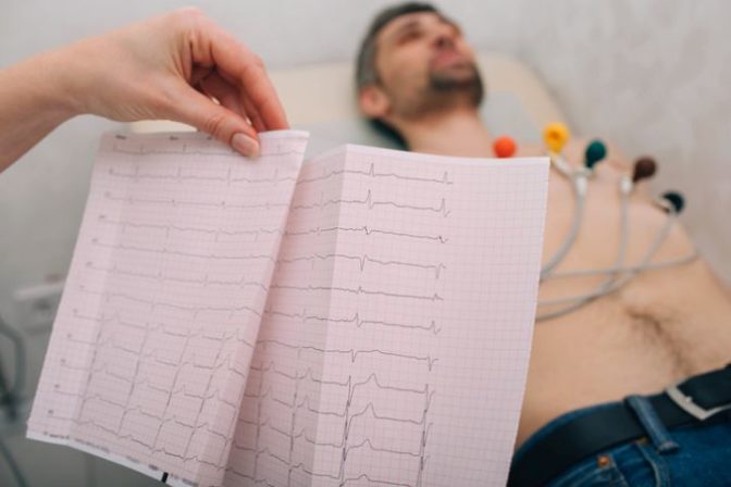 EKG, pacient, infarkt