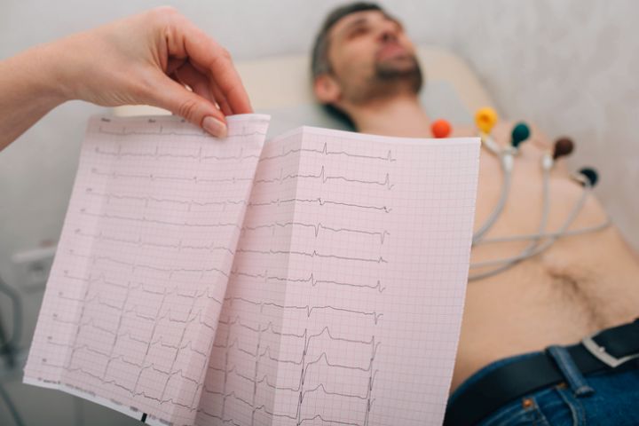 EKG, pacient, infarkt