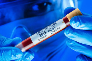 Chinese Coronavirus Blood Test Concept